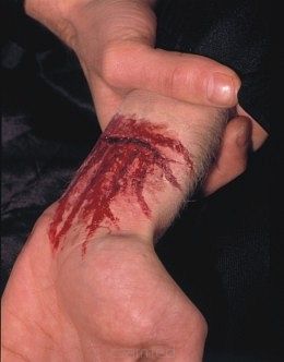 Rana Latexowa - podcięta żyła na ręce