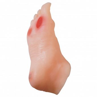 Model Stopy Cukrzycowej